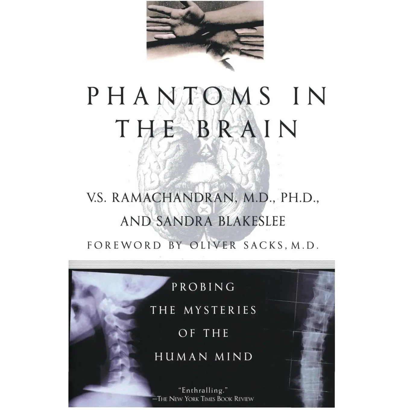 Phantoms in the Brain: Probing the Mysteries of the Human Mind