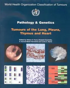 USED-Pathology and Genetics of Tumours of the Lung, Pleura, Thymus and Heart (IARC WHO Classification of Tumours) by The International Agency for Research on Cancer (Paperback)