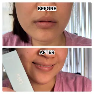Product Review of [Laka] Soothing Prep Lip Mask — Cooling peel-off lip mask for smoother lip prep and a hydrated feel from v**c