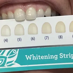 Product Review of GuruNanda Whitening Strips, 7-day treatment (7 Packets - 2 Strips per pack) - Non-Slip, Dry Strip Technology from P**a V**a