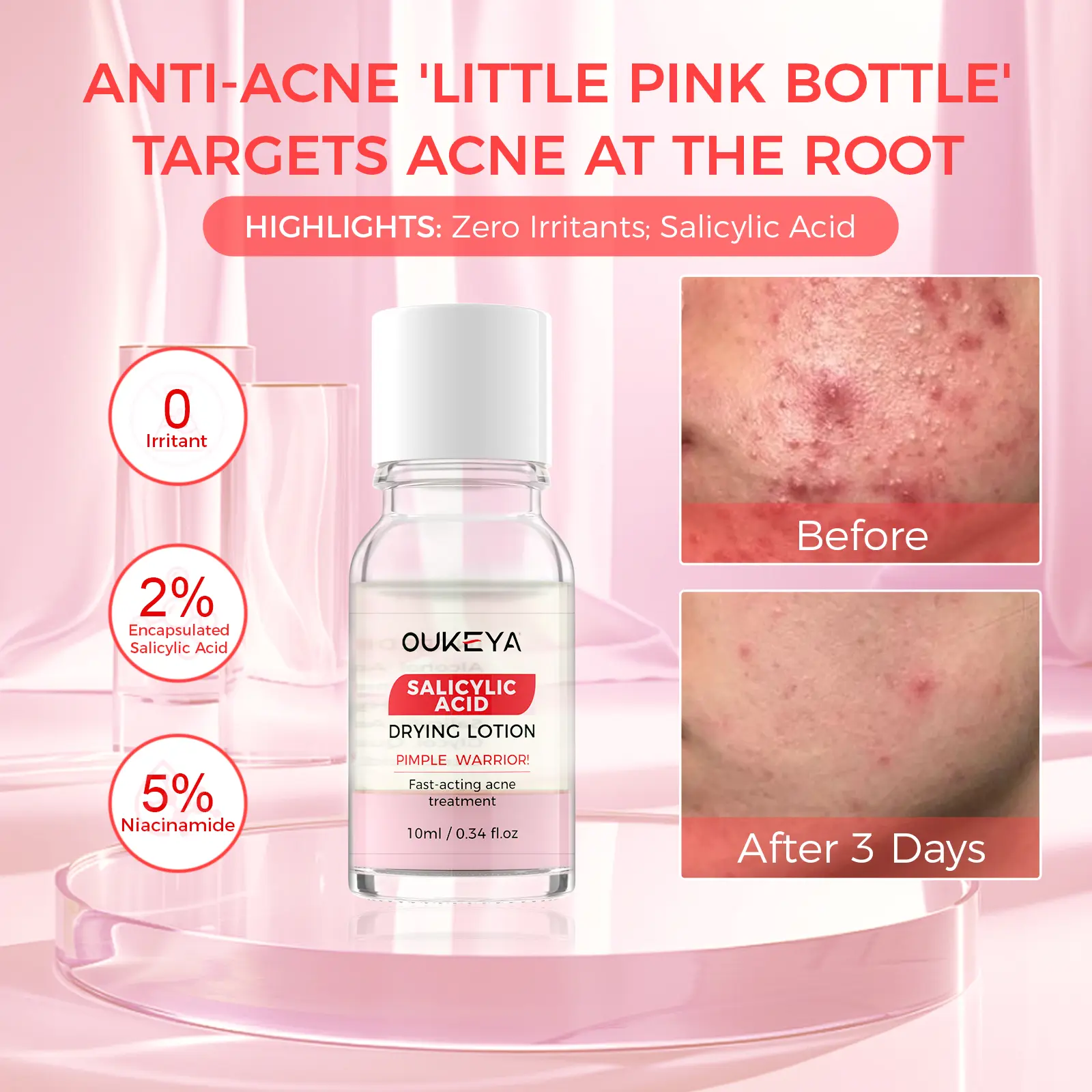 OUKEYA anti-acne essence,removesacne and soothes the skin 10ml acne  clearing  products