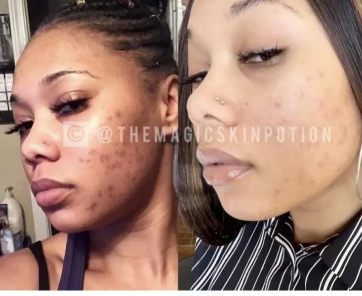 Carmella Dark Spot Remover Cream, 1-2 Week Intensive Face Care Product, Blemish Care Moisturizers & Mists, All Skin Types Pore Solution, Face Care Products