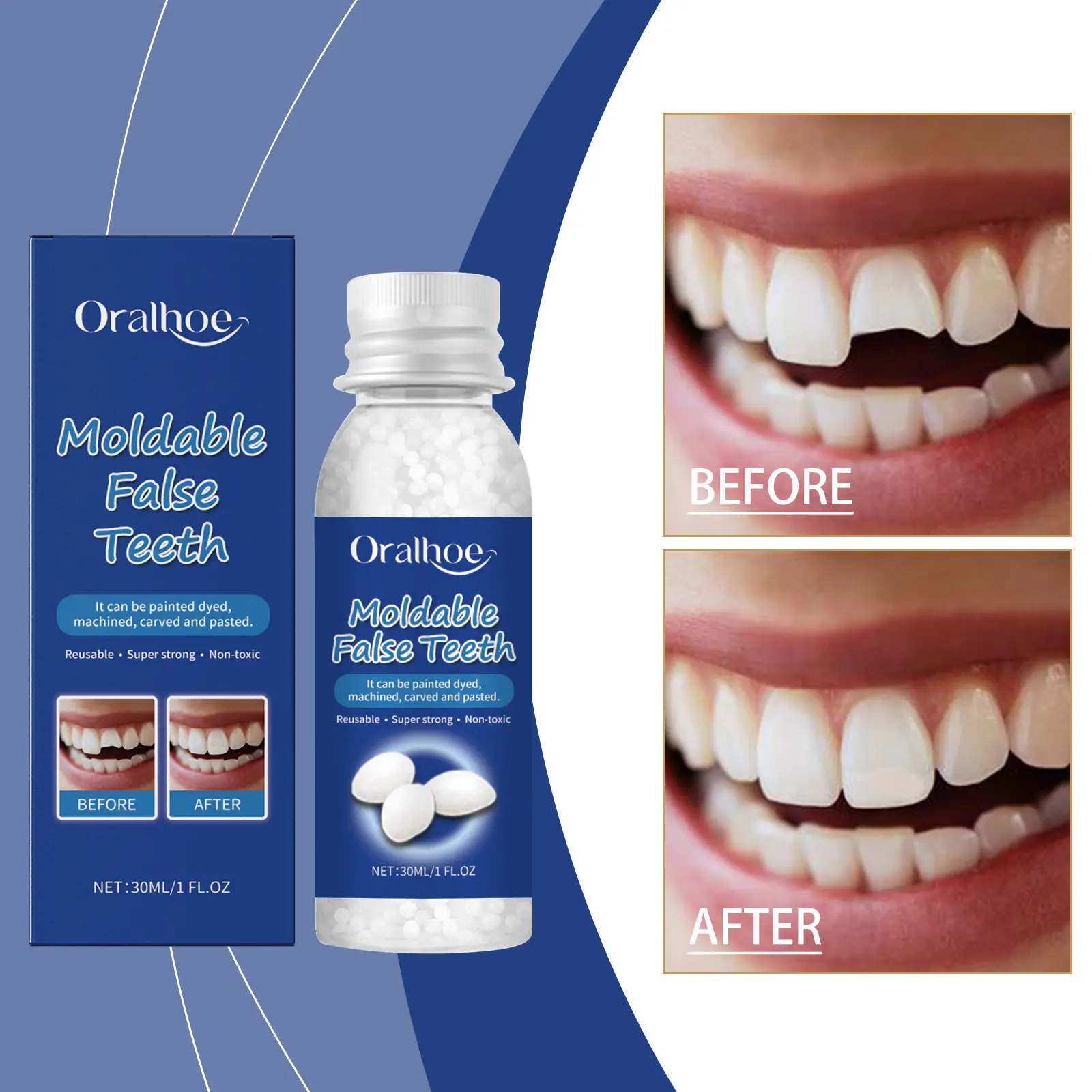 Temporary Tooth Repair Kit, Thermal Fitting Beads, Fake Teeth Solid Glue, Gap Filling & Missing Tooth Repair for Cosmetic Use