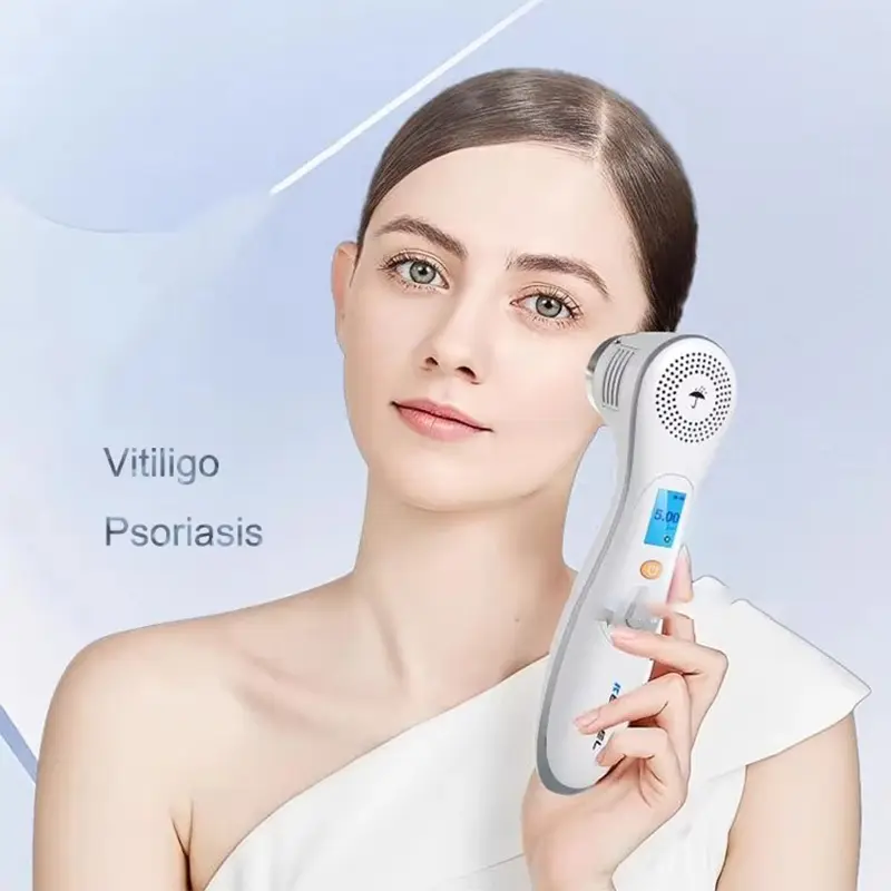 308nm 311nm Excimer Vitiligo Eczema Psoriasis Acne UVB Light Therapy