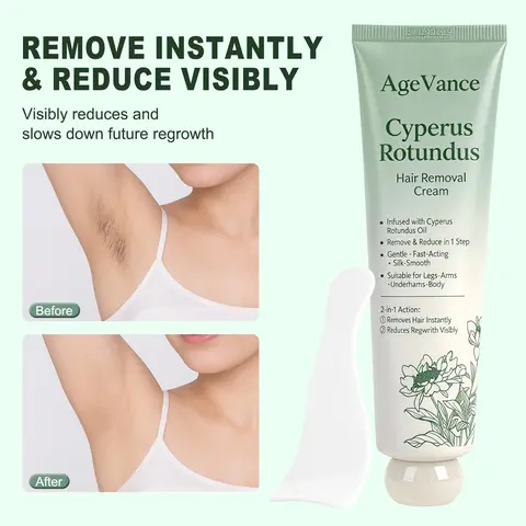 AgeVance Intimate Hair Removal Cream - 5-Min Fast Acting Dermatologist Tested Vegan Friendly 2 in 1 Skin Softening Smooth Body & Bikini Area Hair Depilatory with Natural Extracts & Cyperus Rotundus Oil for Adults' Sensitive Skin, Reduces Regrowth, Skin So