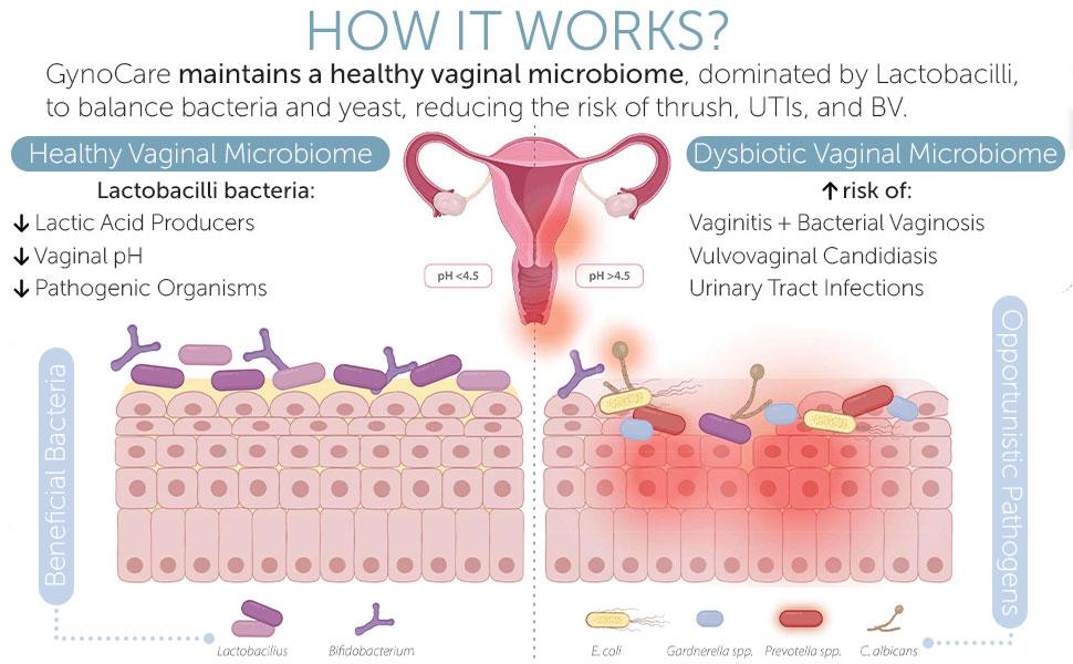 Vaginal Probiotics for Women | Intimate Care & Feminine Care | pH Balance Support | Yeast Infection & Bacterial Vaginosis Defense | Helps Reduce Burning & Excess Discharge | 10 Count