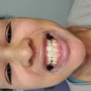 Product Review of NIDA Youthful Formula Ultimate Moisturizing Cream (100mL) / Collagen, Niacinamide, Centella Asiatica, Hyaluronic Acid / Wrinkles, Dark Spots, Skincare Hydrating Daily Moisturizer Moisture Hydrate from s**r m**