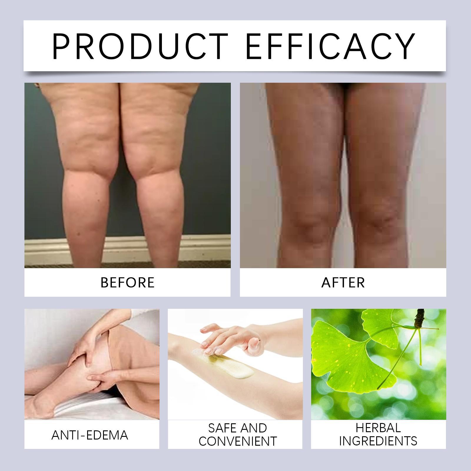 Leg Care Cream Relieves Leg Discomfort Repair Daily Body Care Moisturizing Skin Massage Cream