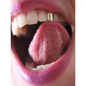 Single tooth braces, one of the best-selling accessories, a fashionable single tooth brace that showcases elegance, made of edible materials and dental gemstones