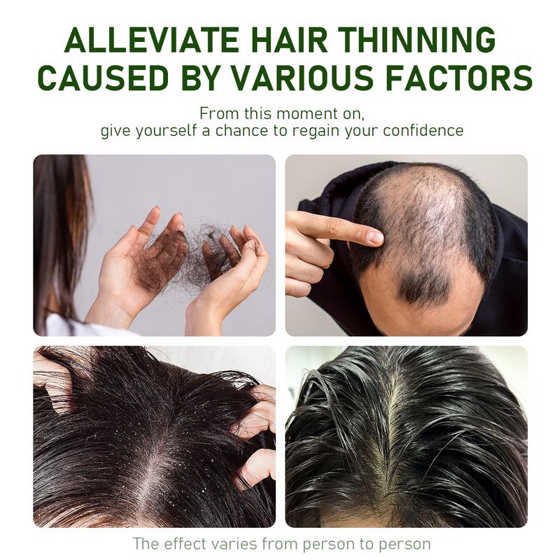 BSAPY Anti Hair Loss Shampoo Bar 120g DHT Blocker with Polygonum Ginseng & Tea Tree Strengthens Roots Reduces Hair Fall Sulfate-Free Herbal Hair Growth Soap HR