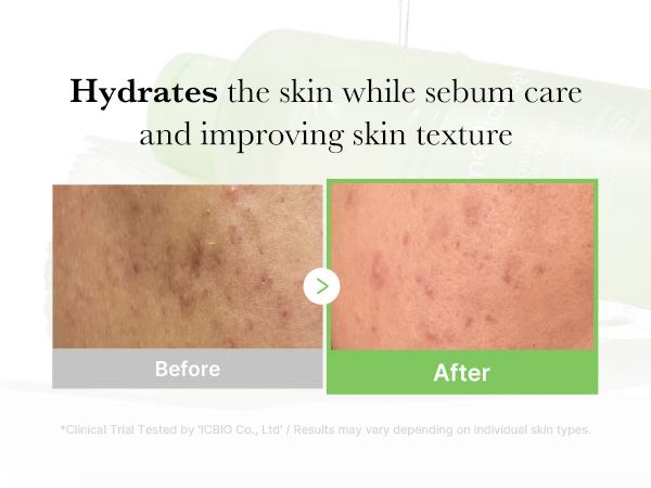 [Official Shop] Exosome Cica Toner | Daily Soothing Toner With Exosome Cica, Heartleaf, Tea Tree | Korean Skin Care for Stressed Skin