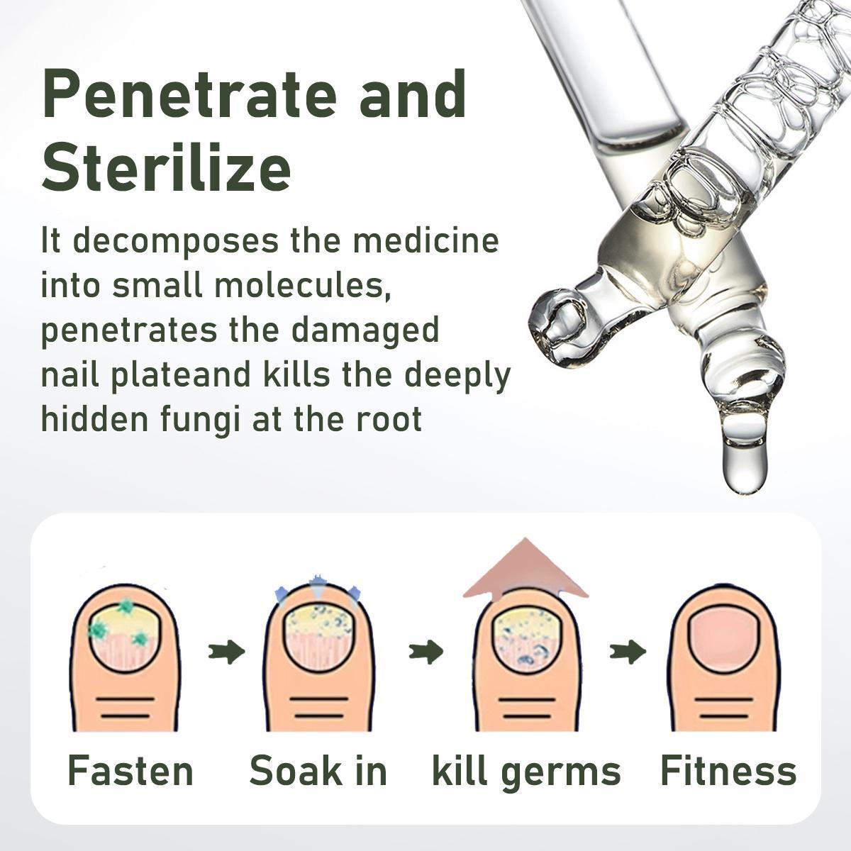 Nail Fungus Treatment, Extra Strength Nail Serum, Triple Action Formula for Damaged Nails Care & Healthy Looking Nails Nail Fungus Treatment, Extra Strength Nail Serum, Triple Action Formula for Damaged Nails Care & Healthy Looking Nails