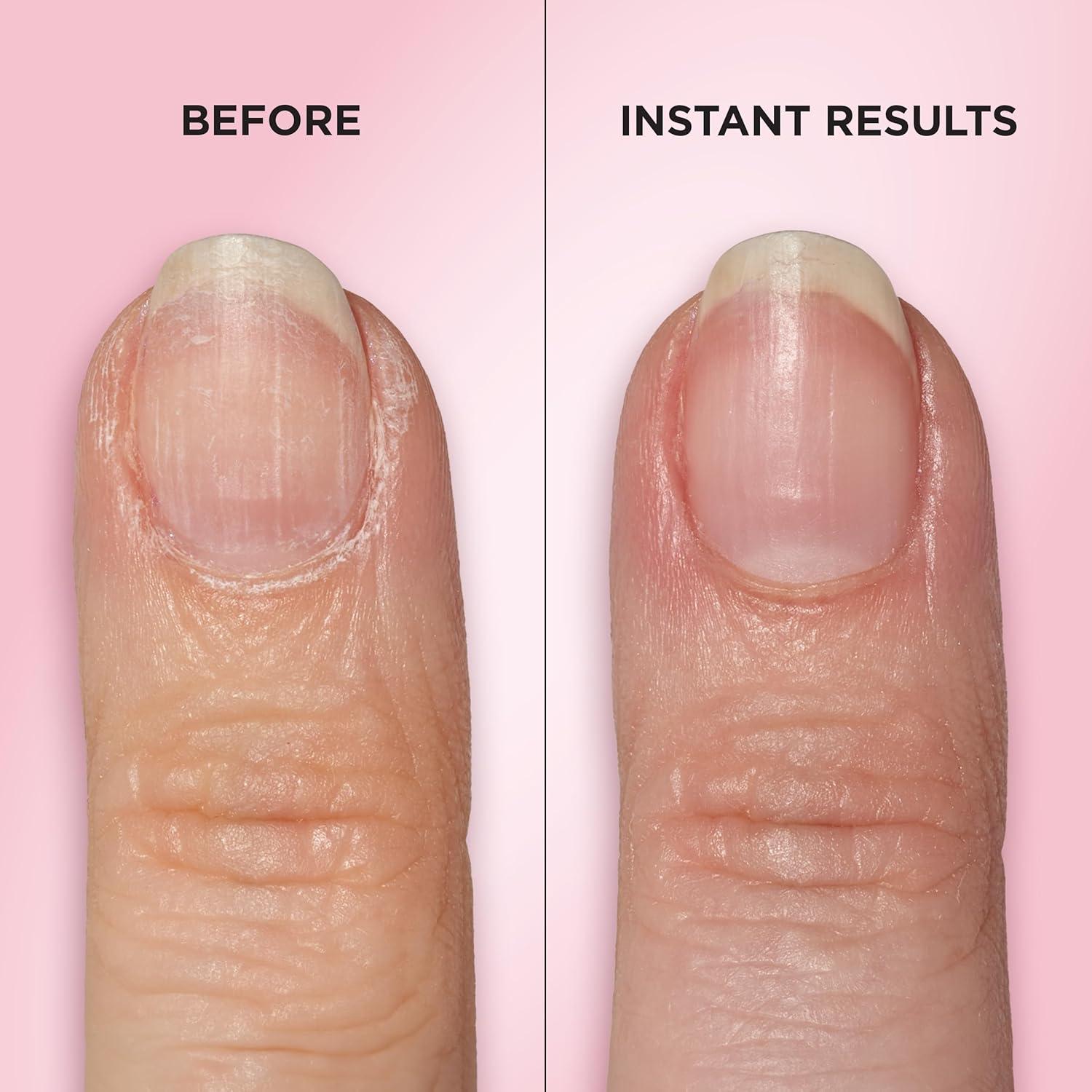 Nail Cuticle Oil & Strengthener Serum, Nourishes Dry Cuticles, Repairs Brittle & Peeling Nails, Moisturizes Nail Edges, Promotes Healthy Nail Growth, Non-Greasy Vegan Nail Care