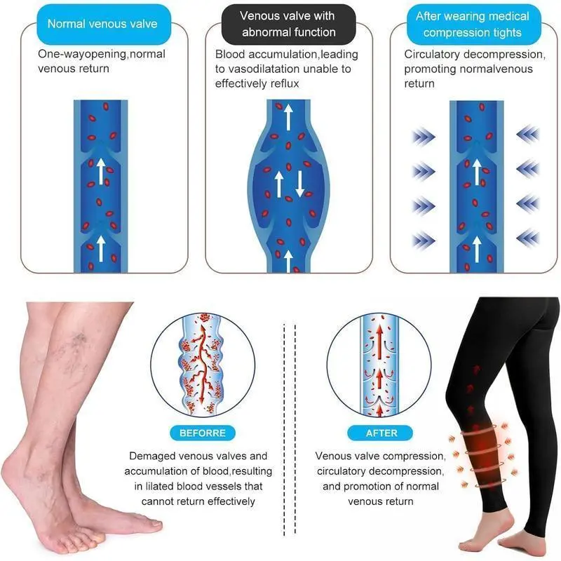 2 Pairs Medical Compression Pantyhose for Women & Men, 20-30mmHg Graduated Support Tights, Opaque Footless High Waist 2 Pairs Medical Compression Pantyhose for Women & Men, 20-30mmHg Graduated Support Tights, Opaque Footless High Waist