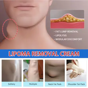 Relieve subcutaneous lumps caused by lipoma-fat cream，Body Care Supply