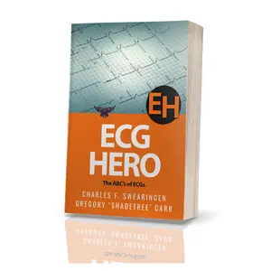 ECG Hero: The ABCs of ECGs by Charles F Swearingen