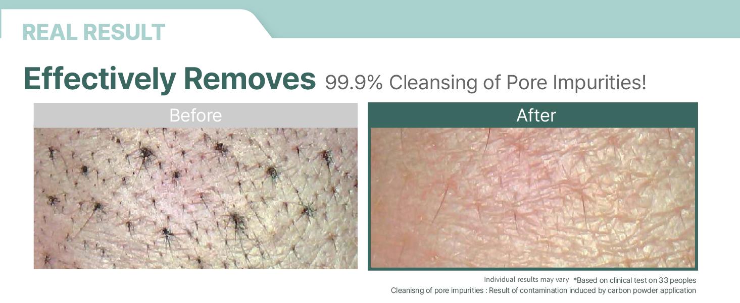 ILLIYOON Gentle Foaming Deep Facial Cleanser | Hypoallergenic & Sensitive Skin-Friendly, Cleanser for Dry and Acne-Prone Skin, Oil Control, Vegan-Certified, 8.45 fl. oz. (250ml) ILLIYOON Gentle Foaming Deep Facial Cleanser | Hypoallergenic & Sensitive Skin-Friendly, Cleanser for Dry and Acne-Prone Skin, Oil Control, Vegan-Certified, 8.45 fl. oz. (250ml)