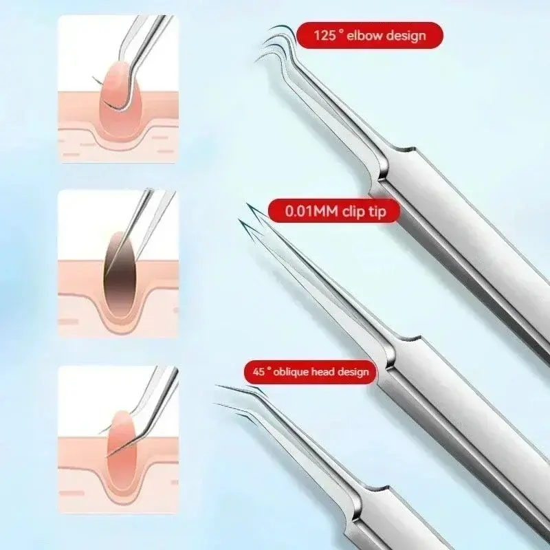 Stainless Steel Pimple Tweezers Set, Facial Blackhead Remover, Fine Needle Tweezers for Acne Treatment, Skincare Tool Kit, Stainless Acne Extractor, Facial Care Tools, Self Care Tools, Beauty Tools