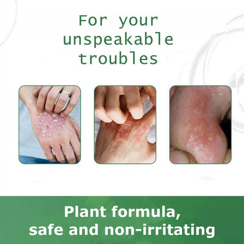 Umex All-Natural Plant-Based Herbal Relief Cream – Soothes Eczema, Psoriasis, Dry & Sensitive Skin | Ancient Botanical Formula for Whole Family Moisturizing Daily