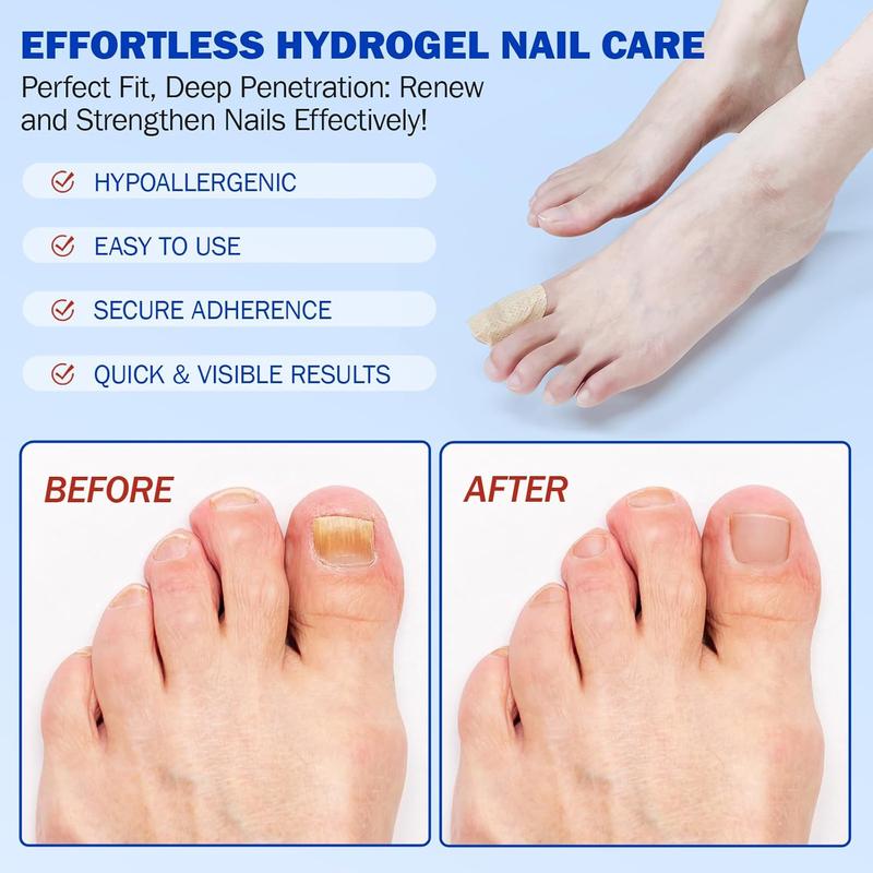 Overnight Nail Recovery Patches – Medical-Grade Hydrogel with Intensive Repair for Weak, Thin or Broken Nails, Effortless Daily Care
