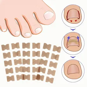 Ingrown Toenail Correction Patch, 30pcs/set Breathable Toe Nail Correction Strip, Professional Pedicure Tool for Home & Beauty Salon Use