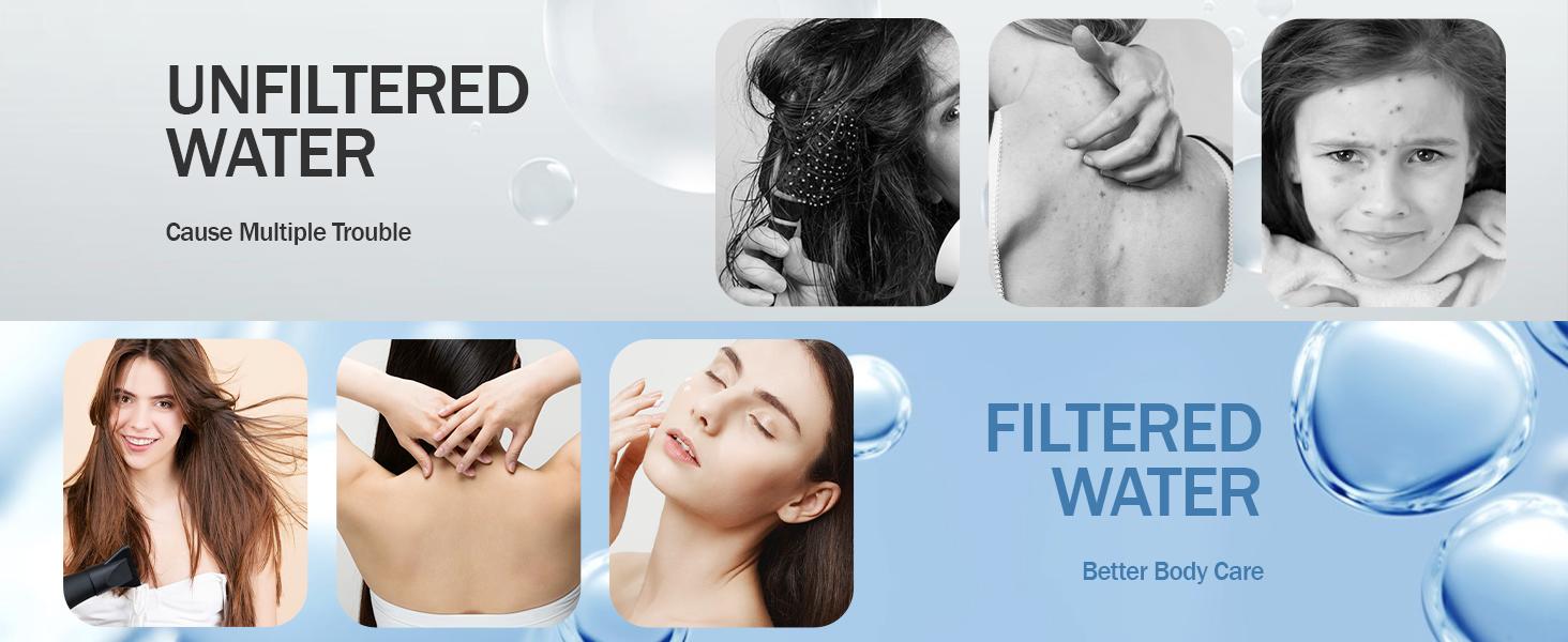 Shower Filter, 20 Stage Shower Head Filter for Hard Water with High Output Shower Water Filter to Remove Chlorine, Fluoride and Other Impurities, Improves Skin Condition, Protects Hair