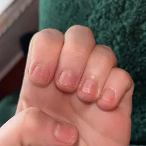 Product Review of Radiant Cosmetics Nail Growth Oil - 100% Organic, Moisturizing, Growth, Strengthening, and Brightening Formula with Vitamins and Fatty Acids for Overall Nail Health from E**