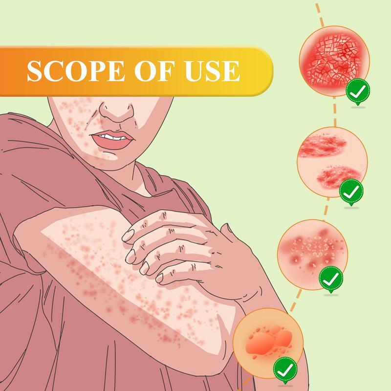 Herbal Antifungal Cream – Soothes Itching from Psoriasis, Eczema, Ringworm, Jock Itch, Athlete’s Foot, Toenail Fungus, Yeast Infection & Tinea – 100% Plant-Based, Steroid-Free – Restores Dry Cracked Skin & Protects Against Recurrence