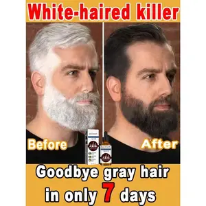 White hair killer, remove gray hair and restore natural hair color in 7 days