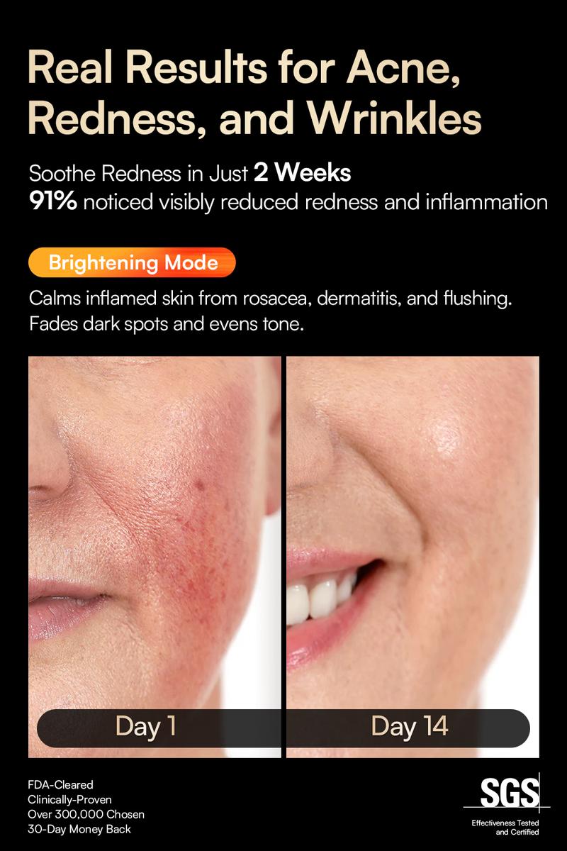 INIA GLOW Wireless LED Face Mask, 2-Year Warranty, Portable and Rechargeable for LED Facial Mask Skincare at Home and Travel, The Ultimate Gift Choice for this Season INIA GLOW Wireless LED Face Mask, 2-Year Warranty, Portable and Rechargeable for LED Facial Mask Skincare at Home and Travel, The Ultimate Gift Choice for this Season