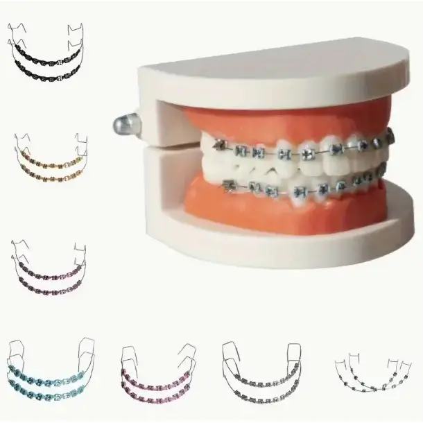 Metal Bracket Teeth Decoration - Stylish Metal Bracket Teeth with Hs for Modeling and Teaching Ai, Durable Dental Material Oral