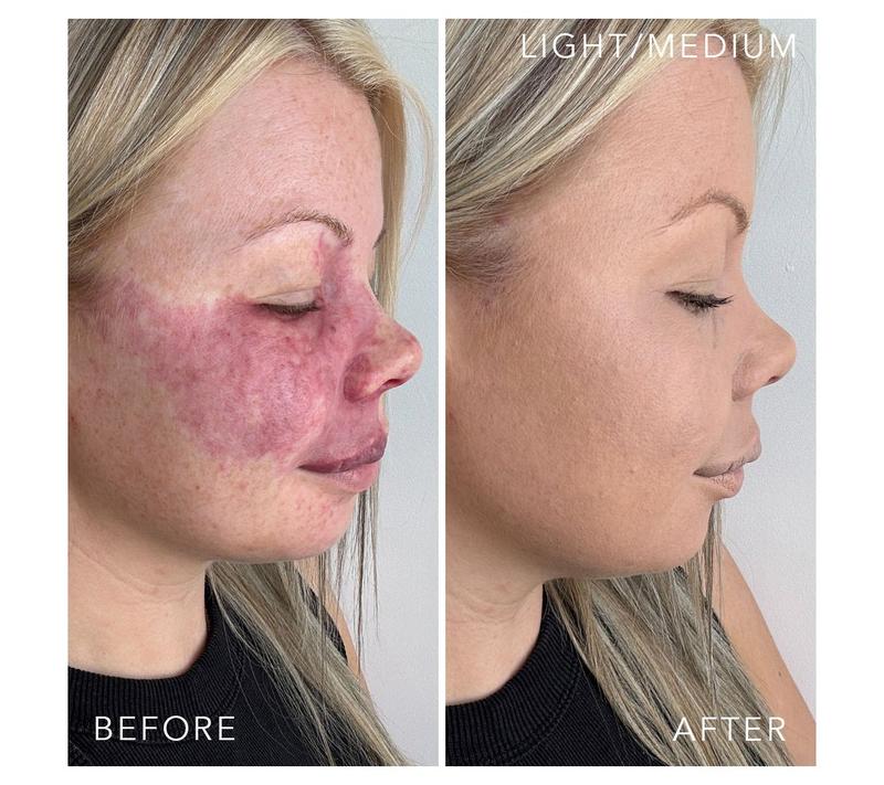 Doll 10 TCE Foundation with Special Edition Brush