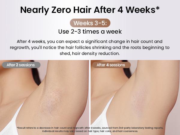 Laser Hair Removal Ice Cooling, Painless IPL Laser Hair Removal Device At-Home Permanent ipl device Portable IPL Smooth Comfort IPL Hair hair remival