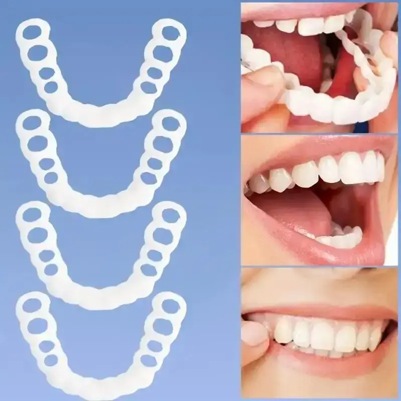 Unisex Silicone Dental Braces 4pcs Set - Adjustable White, Easy to Clean, Natural Fit, Confident Smile Look, Simple Oral Care - Boxing Oral Equipment, Ideal Christmas Gift, Secure Fit