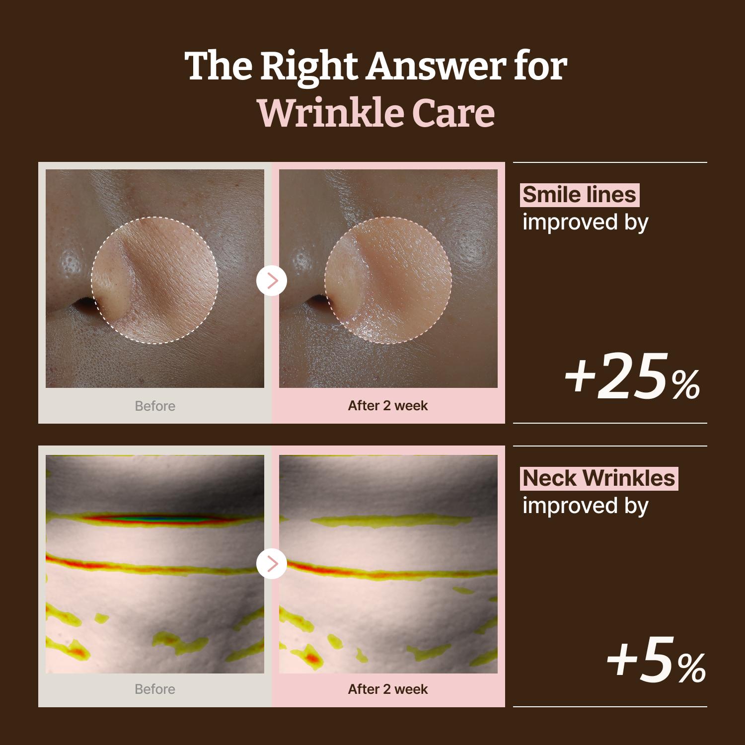 [Dr.Reju-All Official]Dr. Reju-All Advanced PDRN Rejuvenating Mask - Face & Neck Korean Sheet Mask with 1,200 ppm PDRN, Collagen & Copper Peptides - Hydrating & Soothing, Skin Repair (1.2 Fl Oz x 4EA)