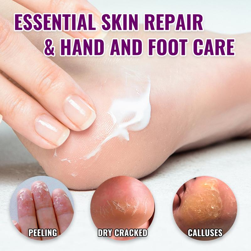 Clearzal  Dry Cracked Feet Repair UltraHydrating Hand and Foot Cream Crusty Moisturizer, 3.5 oz. Contains Urea, Salicylic Acid, for Dry, Chapped, Cracked Feet, Dead Skin Remover, For Thick, Cracked, Rough Skin , dead skin and dry skin cream