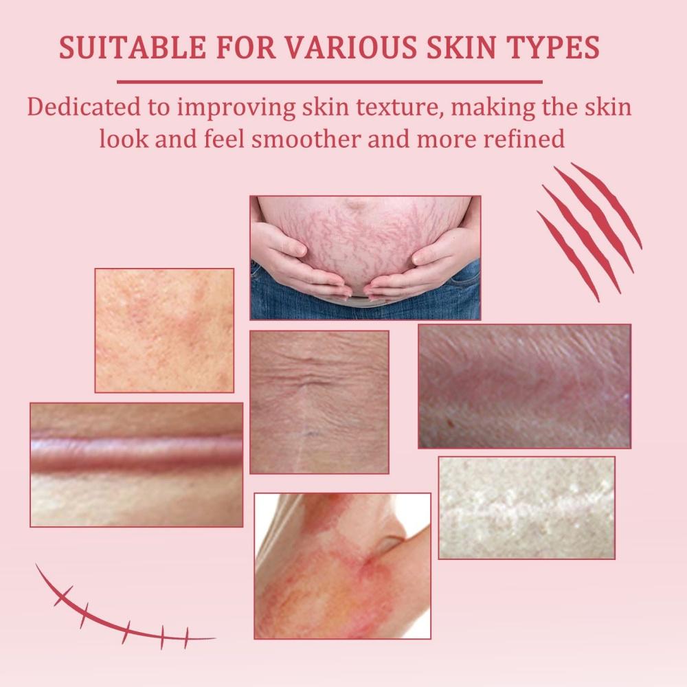 Scar Soothing Cream & Smoothing Cream for Scars,Helps Improve Appearance for Surgical Scars and Keloid Bump, Reduces Redness,For Skin Recover Smooth