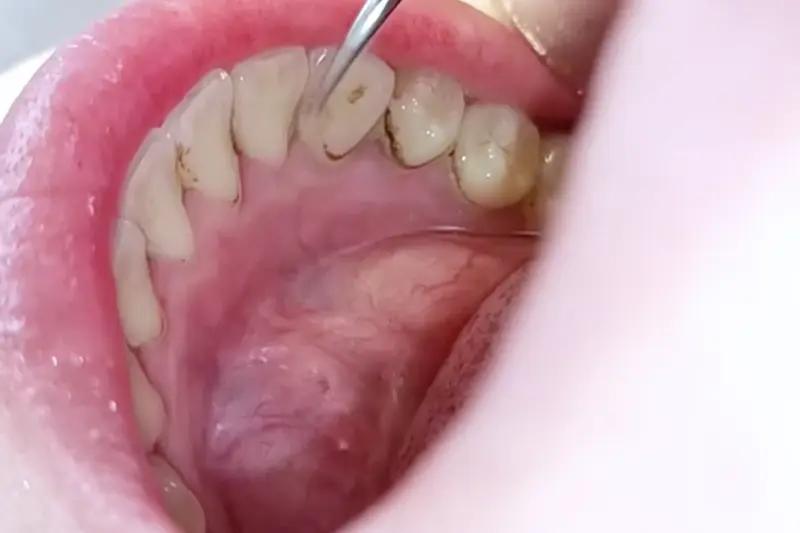 Multi-function & Multi-Speed Electric Toothbrush