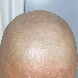 48/24-Piece Men's Razor Blade Replacement Set with Handle - Ultra Sharp Stainless Steel Blades for Smooth Shaving, Works with Standard Razor Handles, Bulk Disposable Blades Face Head Body Shaving