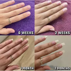 Organic Nail Growth Oil for Growth, Strengthening, Brightening and Moisturizing - Nail Vitamin Essentials (Vegan & Cruelty-free)