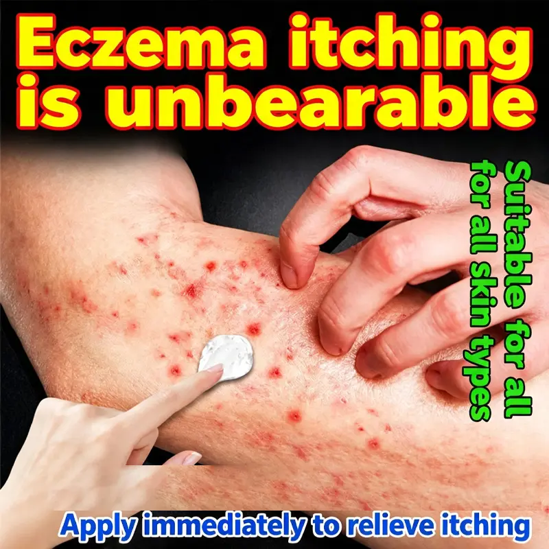 Antipruritic and Antibacterial Ointment, suitable for relieving skin itching and red rashes, suitable for the whole body, gentle and non irritating, herbal ointment.