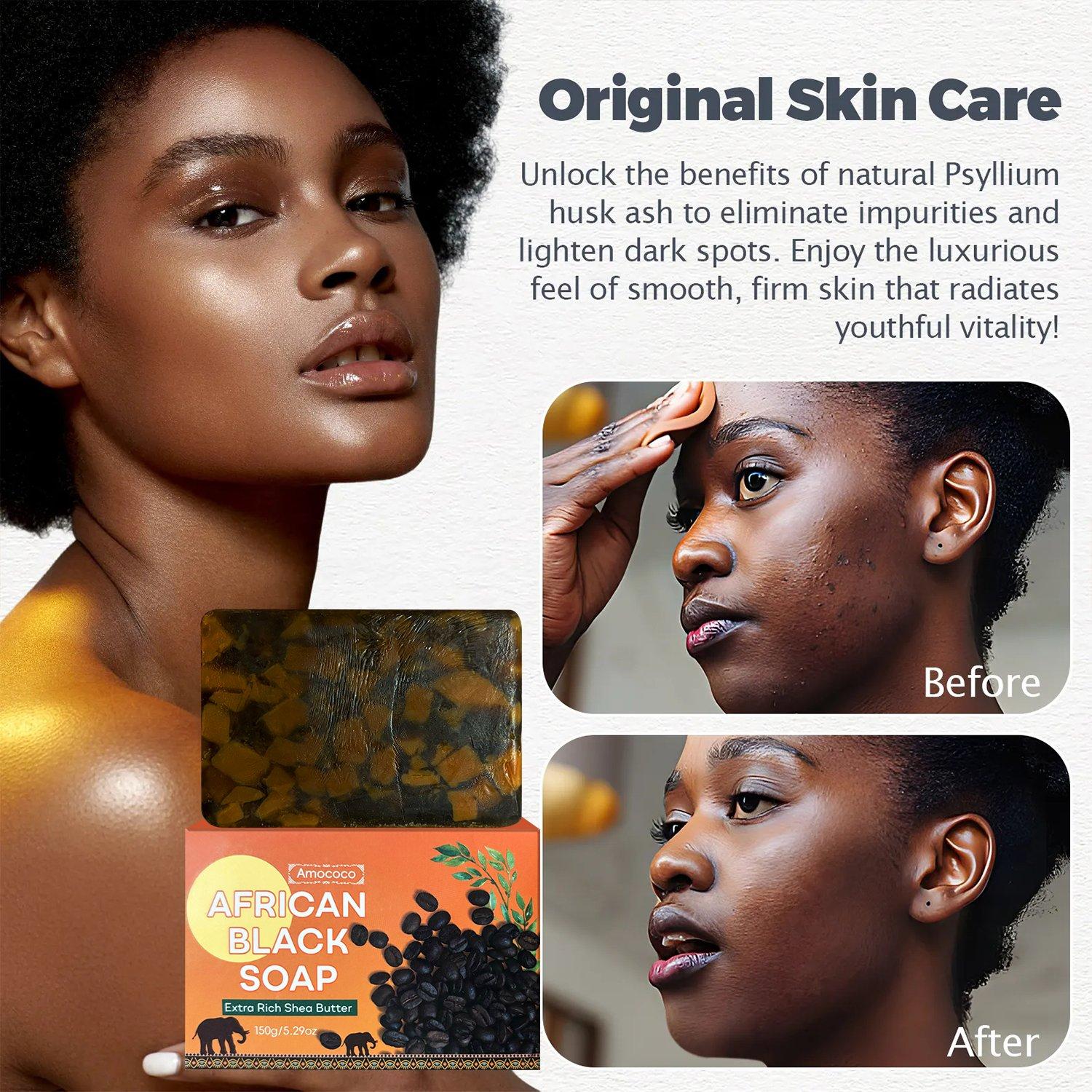 Amococo African Black Soap Bar with Shea Butter | Deep Cleansing, Acne & Dark Spot Fading, Hydrating for All Skin Types 150g