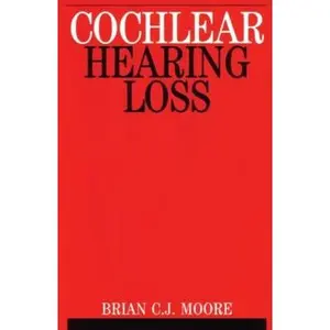 USED-Cochlear Hearing Loss by Moore, Brian C. J. (Paperback)