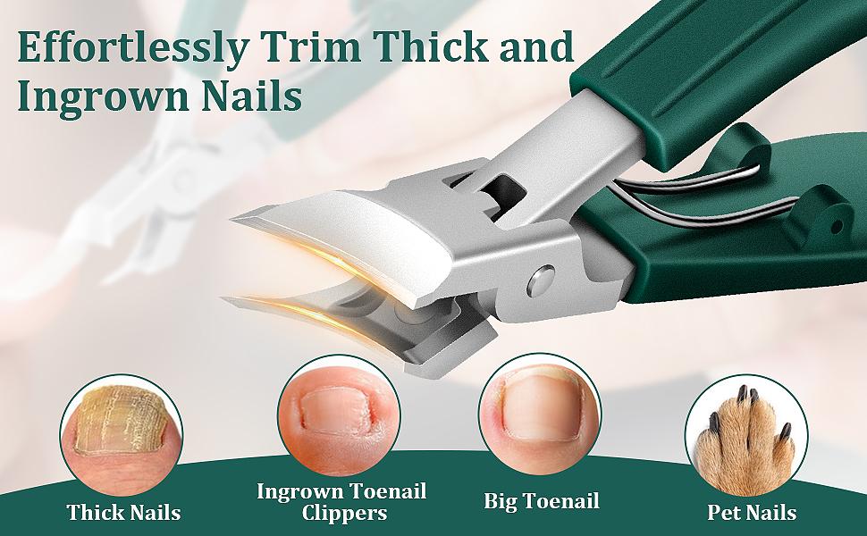 Eagle Beak Nail Clippers for Ingrown & Thick Nails – Beveled/Slanted/Angled Blades, Long Handle Wide Jaw, Anti-Splash Ultra Sharp Stainless Steel Edge 3-Piece Set for Men/Women (Green) Eagle Beak Nail Clippers for Ingrown & Thick Nails – Beveled/Slanted/Angled Blades, Long Handle Wide Jaw, Anti-Splash Ultra Sharp Stainless Steel Edge 3-Piece Set for Men/Women (Green)