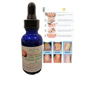 Organic Toenail Fungus Treatment Extra Strength - nail repair, toenail softener yellow toenail treatment, ingrown nail and foot fungus treatment extra strength