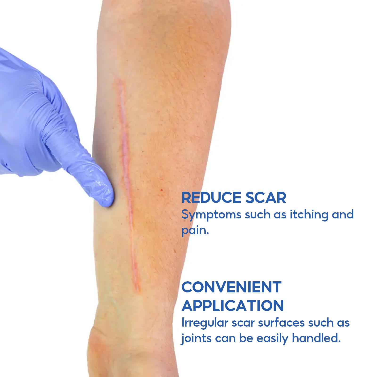 Advanced Silicone Scar Removal Cream for Surgical Acne and Keloid Scars to Effectively Fade Old and New Scars for Smoother Hydrated Skin 30g