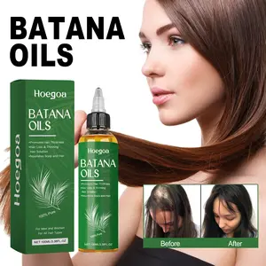 scalp care oil，Hoegoa hair growth essential oil nourishes and softens hair, repairs roots, strengthens hair care, Batana hair essential oil Haircare Comfort
