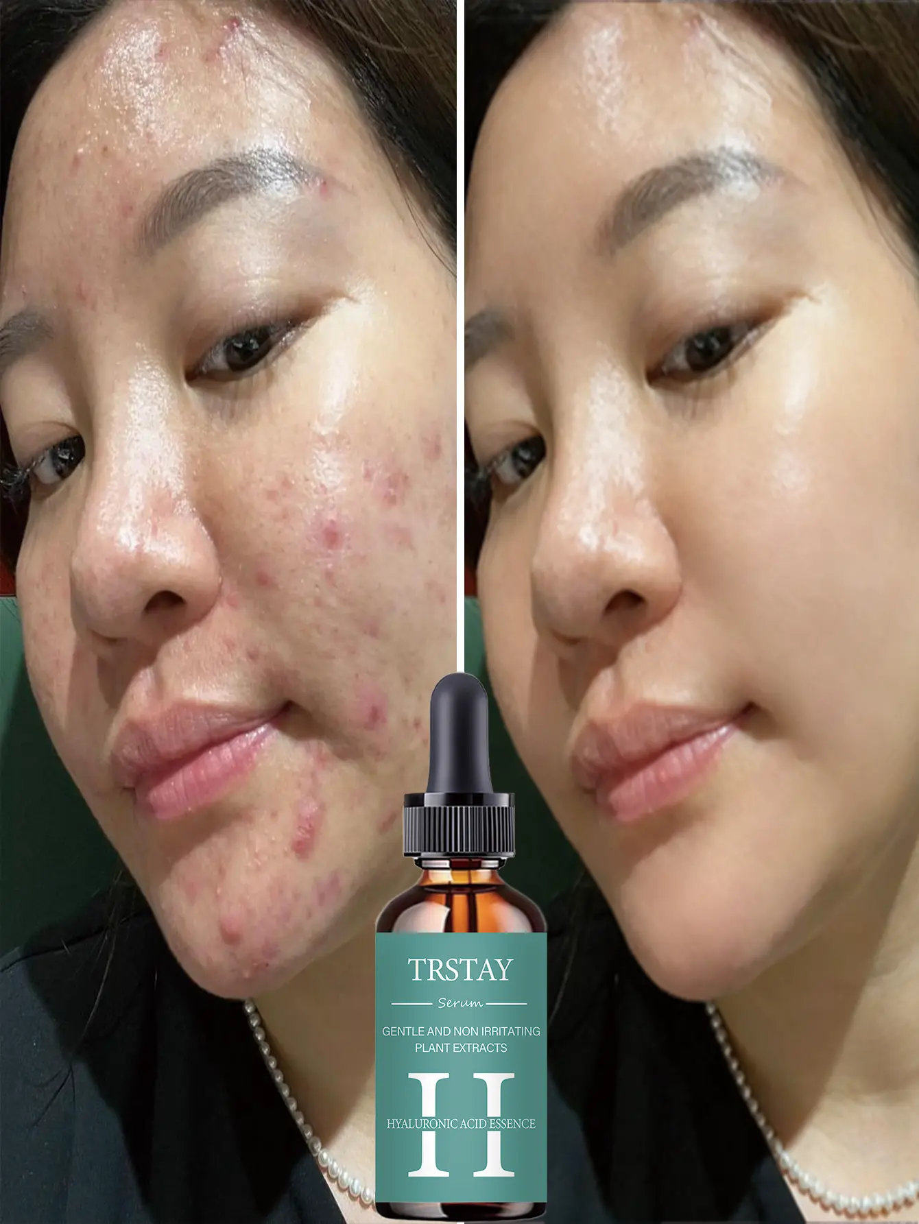 1.7 oz facial serum infused with hyaluronic acid; it leaves the skin feeling soft and supple with a smooth texture and a fresh, radiant glow—suitable for daily skincare.