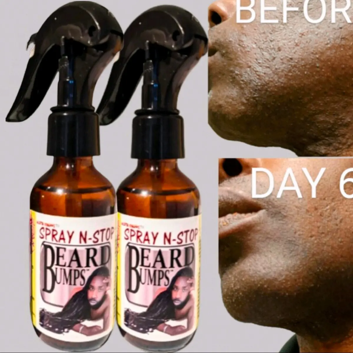 2PACK SPRAY N-STOP BEARD BUMPS
