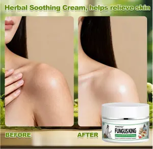 [Monthly Sales: 10,000+] Authentic "Fungus King" — Botanical Extract for Foot Odor & Itching — Topical Skin Relief & Soothing